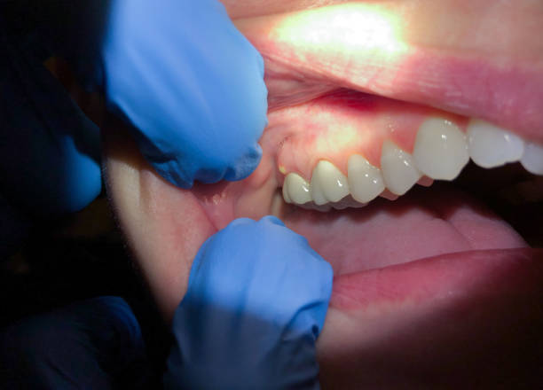 Best Emergency Care for Gum Disease in , WY