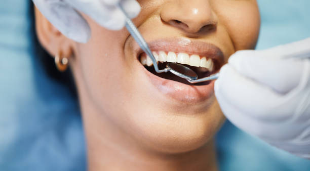 Best Knocked-Out Tooth (Avulsed Tooth) Treatment in , WY